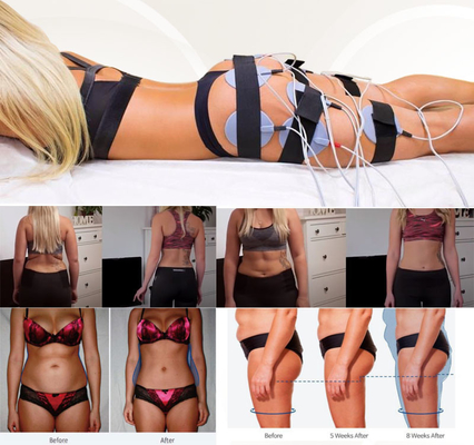 Forme physique électrique de machine de stimulation de muscle du salon SME pour des cellulites