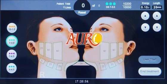 3.0mm 4.5mm 2D HIFU amincissant la peau de machine serrant le retrait de ride