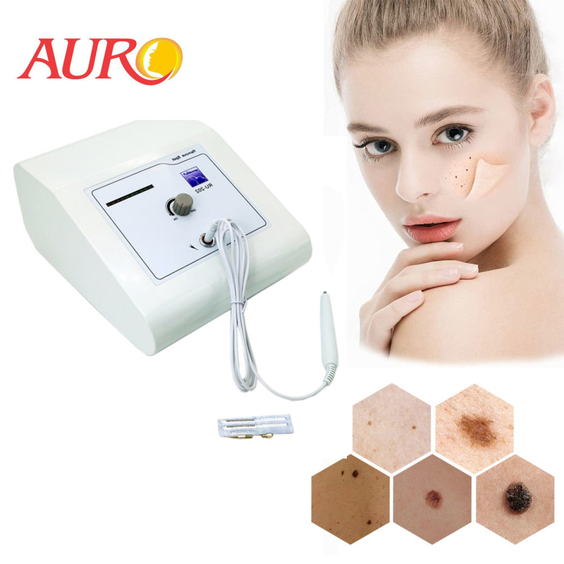 Machine de retrait de taupe d'étiquette de peau de dissolvant de tache d'electrocautery